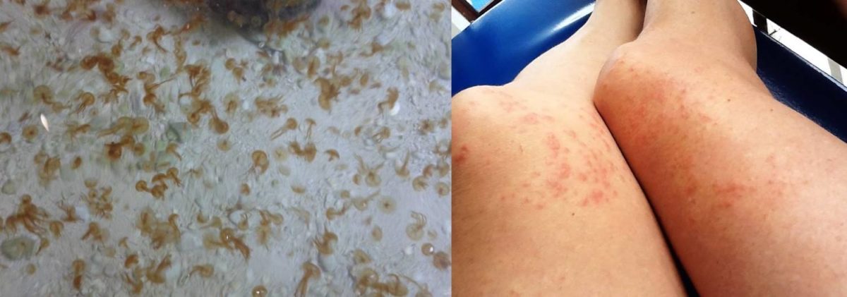 Γονείς προσοχή! Τα μώρα -μέδουσες έχουν κατακλύσει τις παραλίες της Λεμεσού