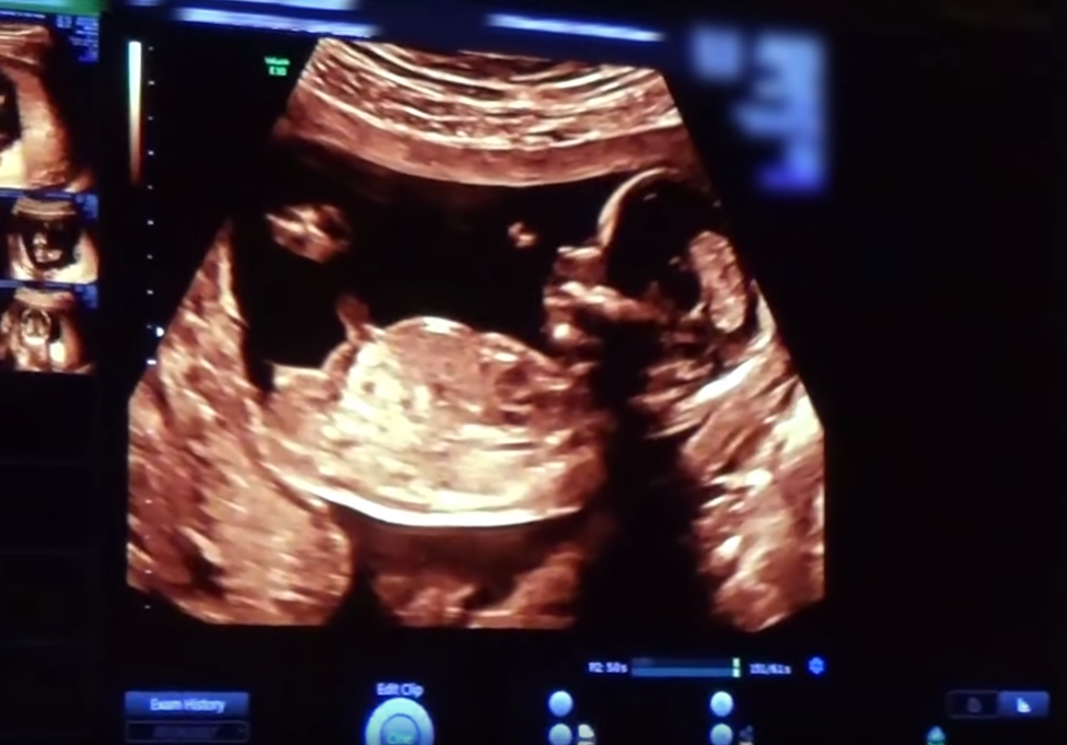 To our daughter: Αυτό είναι το νούμερο 1 βίντεο του YouTube παγκοσμίως για το 2018