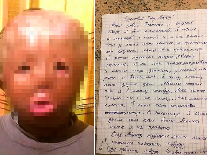 «Άγιε μου Βασίλη χάρισέ μου ένα καινούργιο πρόσωπο»: Το γράμμα ενός 5χρονου που συγκινεί όποιον το διαβάζει