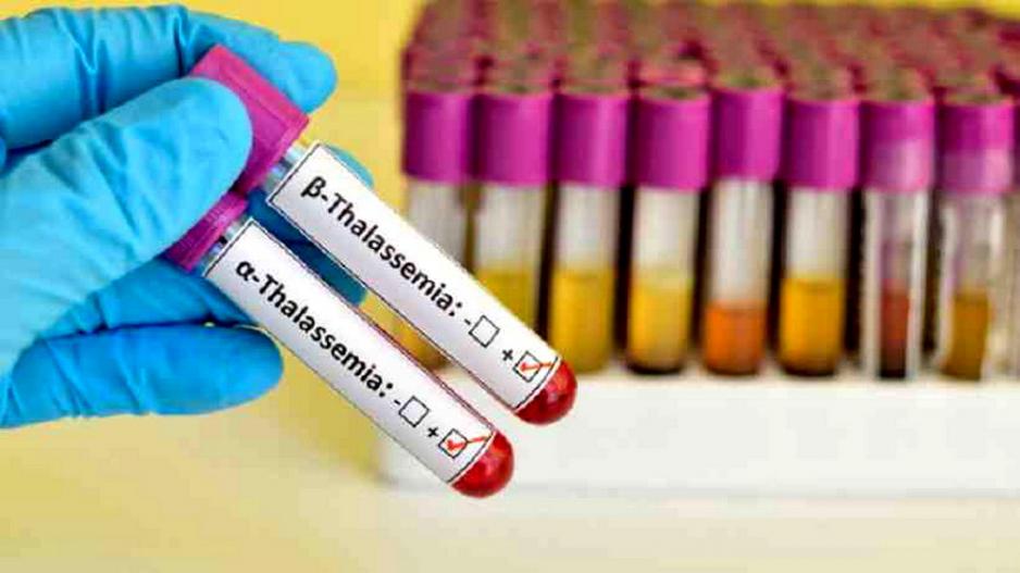 Μεσογειακή Αναιμία: Στην Ελλάδα ο πρώτος ασθενής που θεραπεύτηκε από τη νόσο