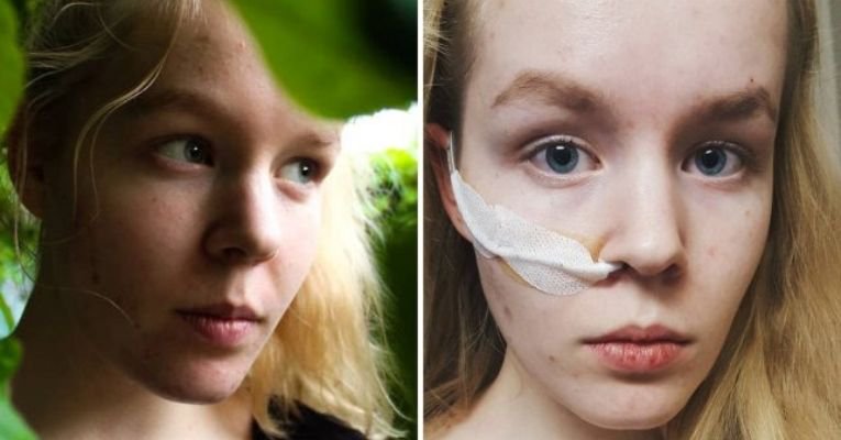 Ανήλικη – θύμα βιασμού επέλεξε την ευθανασία: Μια ιστορία που συγκλονίζει