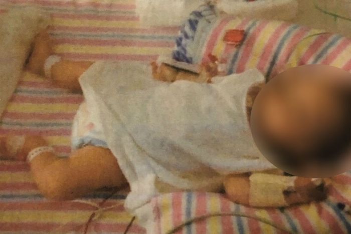 Απίστευτο! Κοριτσάκι 19 μηνών κινδύνευσε επειδή οι γονείς του το υπέβαλαν σε vegan διατροφή