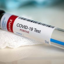 Είναι τελικά αξιόπιστα τα PCR και τα rapid στην Κύπρο;