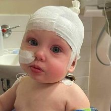 Γονείς προσοχή! Μωρό 7 μηνών παραλίγο να τυφλωθεί από πιστολάκι μαλλιών!