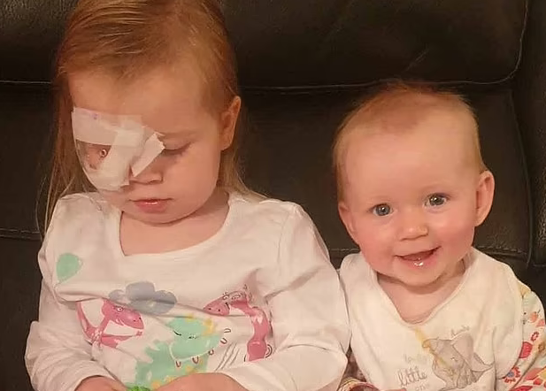 Κοριτσάκι 3 ετών έχασε το μάτι της από σπάνια μορφή καρκίνου