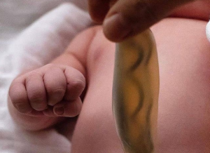 Ομφάλιος λώρος: Η εξωπραγματική τελειότητά του σε μία φωτογραφία