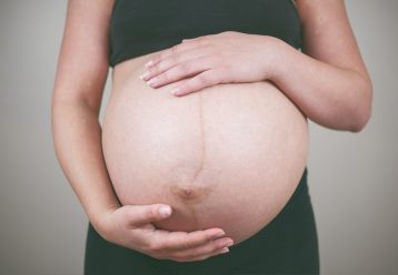 Διάσταση ορθών κοιλιακών: Το πρόβλημα μετά τον τοκετό για το οποίο σπάνια μιλά κανείς