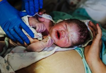 Vernix caseosa: Το «βουτυράκι» που έχουν τα μωρά όταν γεννιούνται είναι μία θαυματουργή ουσία