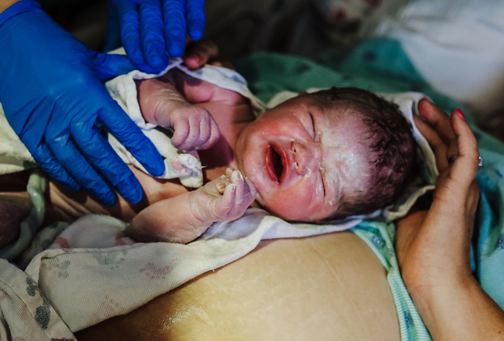 Vernix caseosa: Το «βουτυράκι» που έχουν τα μωρά όταν γεννιούνται είναι μία θαυματουργή ουσία