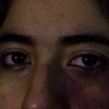 16η γυναικοκτονία στην Ελλάδα φέτος: Σάπισε στο ξύλο την 29χρονη μητέρα των τριών παιδιών του