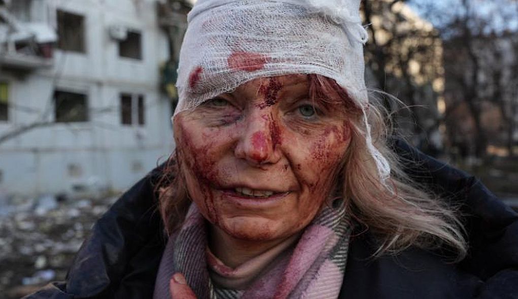Ουκρανία: Η δασκάλα που έγινε σύμβολο της τραγωδίας στην Ουκρανία