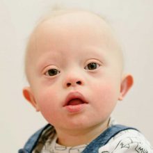 «Σταματήστε τα post λύπησης για τα παιδιά με αναπηρίες. Είναι άνθρωποι και αξίζουν σεβασμό»