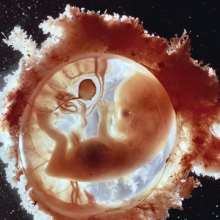 «Εμβρυο 18 Εβδομάδων»: Η φωτογραφία που προκάλεσε φρενίτιδα και έγινε το «κλικ» του αιώνα (εικόνες)