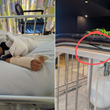 5χρονος “έχασε” τον αντίχειρά του στις σκάλες εμπορικού κέντρου