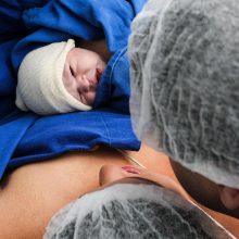 «Πρωταθλήτρια» στις καισαρικές η Κύπρος - Τι ζητούν οι νοσηλευτές για τη μείωσή τους