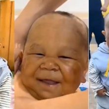 Αυτό το μωρό είναι 29 ετών - Η σπάνια πάθηση που δεν το αφήνει να μεγαλώσει (video)
