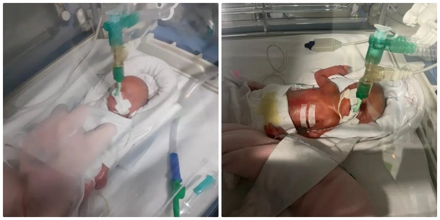 Γέννησε πρόωρα στην Κύπρο και τώρα της ζητούν 30.000 λίρες για να μεταφέρει το μωρό της στη χώρα της