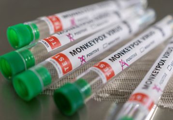 Επιβεβαιώθηκε το πρώτο κρούσμα ευλογιάς των πιθήκων στην Κύπρο