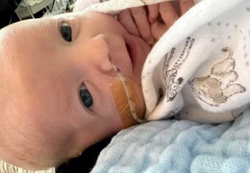 Πρωτοποριακή επέμβαση καρδιάς έσωσε νεογέννητο - Ελπίδα και για άλλους ασθενείς