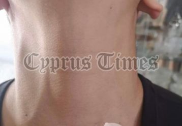 Τι συμβαίνει στα σχολεία της Λεμεσού; Κατήγγειλαν καθηγητή ότι έπιασε από το λαιμό μαθητή!