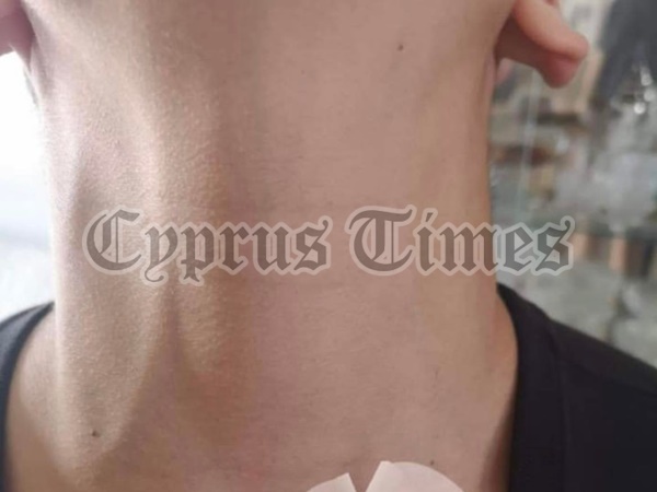 Τι συμβαίνει στα σχολεία της Λεμεσού; Κατήγγειλαν καθηγητή ότι έπιασε από το λαιμό μαθητή!