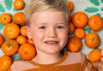 6χρονος... αλλάζει χρώμα στο δέρμα του, όταν τρώει πορτοκάλια - Μία ιδιαίτερη περίπτωση
