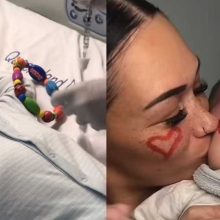 «Έκραξαν» μαμά που θέλει να κάνει λέιζερ στο μωρό της με εκ γενετής σημάδι